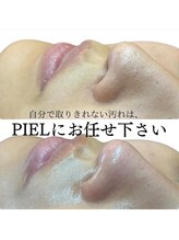 ピエル 北千住店(PIEL)/自分で取りきれない汚れはpielへ