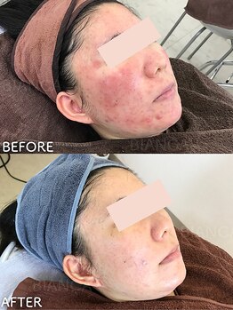 ビアンカ/お客様のお声