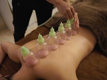 小顔コルギ専門店 フェルーシュ 成田駅前店(Feruche)/カッピング