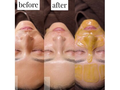ユニエビューティー(Unie Beauty)の写真