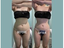 私は痩せにくいから…体質だから…と諦める前にご相談下さい！！