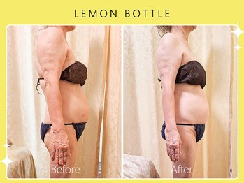 シロカネ 光の森店(SHIROKANE)/レモンボトル☆