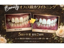 ホワイトニングプラス(Whitening+)の雰囲気（白い歯は自分で手に入れられる！白い歯を取り戻しませんか？）