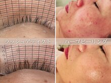 ロカスウィッチ(roca switch)