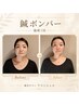 【年齢サイン悩みに】美容鍼×ボンバークリームでたるみ・ほうれい線集中ケア