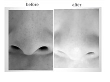 プライベートサロン 美月/すっきりブラッグヘッド