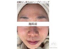 サロンシトロン(Salon.Citron.)の雰囲気（美白集中ケアでくすみのないクリアな上向き肌へ！）