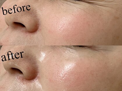 ビューティー サロン アイビー(Ivy)の写真