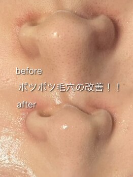 リイル バイ クレビア(REILE by Crebia)/お客様写真