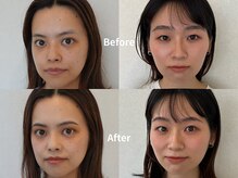 お一人お一人の骨格に合わせてアイブロウデザインを取ります