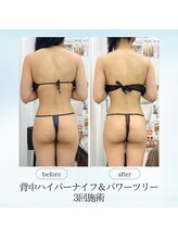 エスプレッソ(espresso,)/【駆け込み花嫁様】3回で激変！