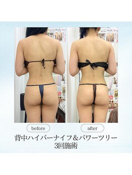 エスプレッソ(espresso,)/【駆け込み花嫁様】3回で激変!