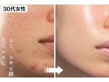 パールホワイトニングサロン 茅ヶ崎店の雰囲気（シミケア+素肌も綺麗に◎ 大小問わずケア可能）