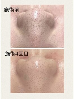 ムーンライズ(moonrise)/