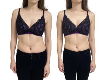 蒼(so)/側湾のお客様・一回の施術。