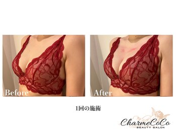 シャルムココ 蔵前店(CharmeCoCo)/お客様Before→After
