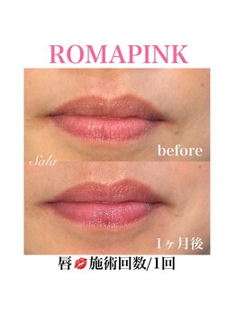 サラ/ローマピンク