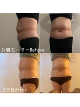 サロン ド モミカル(salon de momikaru)/お腹・美くびれ
