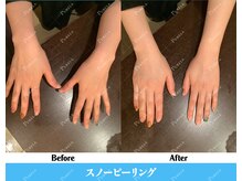 ピュアラ 心斎橋店/日焼け手元すぐ白肌