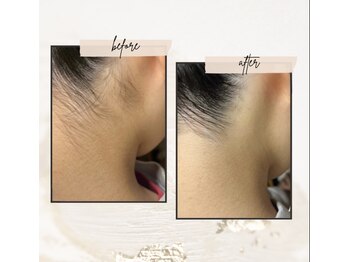 マオ(mao)/☆4回Before→after☆