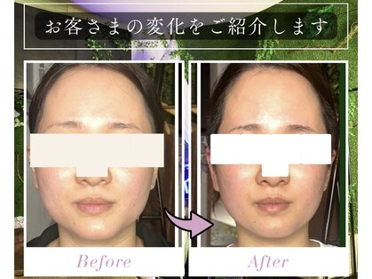 ハルハル(Haru Haru)の写真