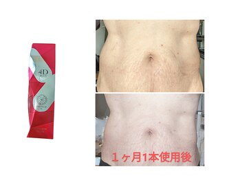 フレクシー/4Dコース　痩身／痩身エステ