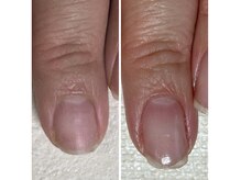 カランコエ(Kalanchoe)の雰囲気（地爪育成3ヶ月の変化）