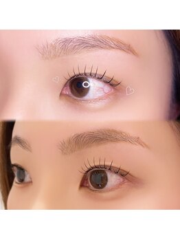 エルレ(ELRe)/フラットラッシュ