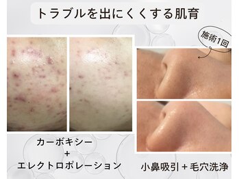 アイリー(iley)/肌代謝アップで肌育