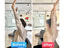 ナオル整体 兵庫院(NAORU整体)/神戸兵庫/施術事例【肩の痛み】