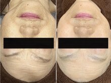 ケイ(Kei)の雰囲気（お肌をキレイに栄養を☆ハーブピーリング）