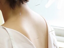 かわしも治療院の雰囲気（鍼灸は深部から身体をあたため不調を改善します。）