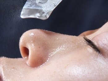 サロン ド ラポール/【毛穴ケア】スキンスクライバー