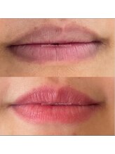 ミイン(美in)/ローマピンク リップ