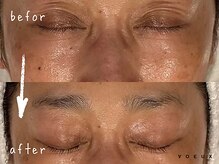 ボウ 名古屋店(VOEUX)/６０代　エイジングケア　週１