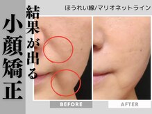 ソワンボーテ(Soin Beaute)の雰囲気(結果重視の小顔矯正 唯一無二の小顔矯正をお試し下さい)