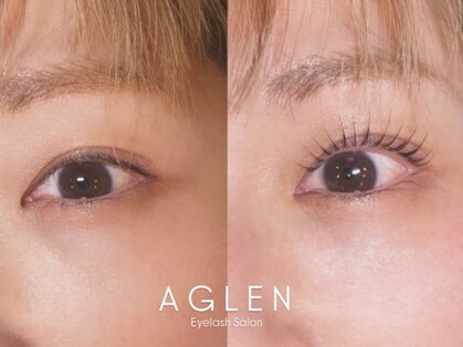 アグレン(AGLEN)の写真