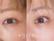 アグレン(AGLEN)の写真