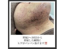 エリクサー 加須店(Elixir)の雰囲気（その場で抜けるヒゲ脱毛はELIXIRだけ！◎）