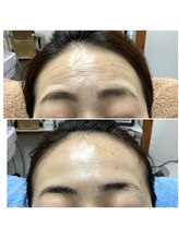 ザ ファーストサロン(The First Salon)/顔筋&小顔マッサージ