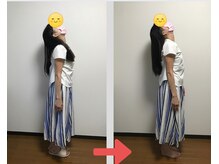 ヌフヌフ(neuf neuf)/トリートメント後のお客様の変化