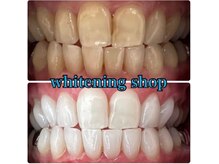 ホワイトニングショップ 加古川店/美白のお手伝いをさせて下さい！