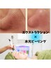 【お得なセットメニュー】毛穴エクストラクション×水光ピーリング　70分