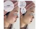 サロンパッテデシャット(salon patte de chat)の写真