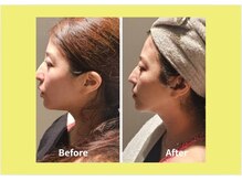 アン 銀座(ann)/驚きの結果