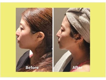 アン 銀座(ann)/驚きの結果