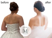 ミヨン(Miyong)/肩こり解消＆背中美人