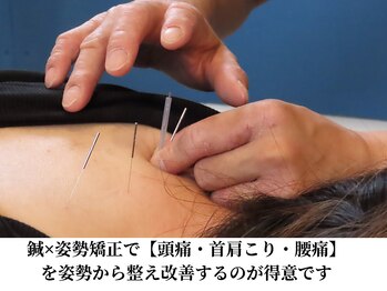 みつばち鍼灸整骨院/頭痛・肩こりが得意分野です