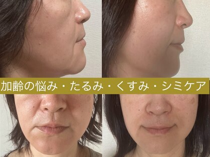 エメ 心斎橋(Aimer)の写真