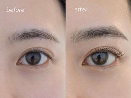 ネストアイ(NEST eye)の写真